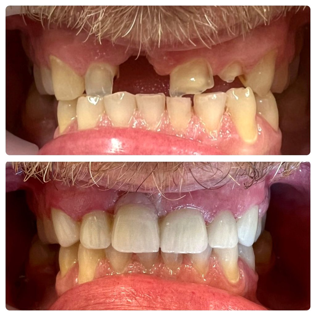 Before & After - Restorative Dentistry